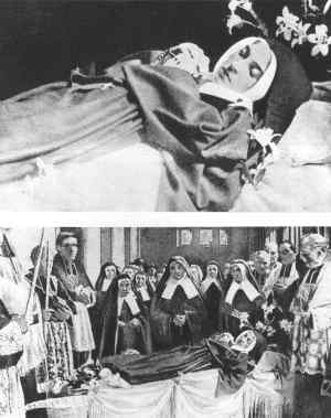 Santa Bernadette, foto (detalhe acima e conjunto) tirada entre após a última exumação (18 de abril 1925) e antes de ser guardada na urna atual (18 de julho 1925)